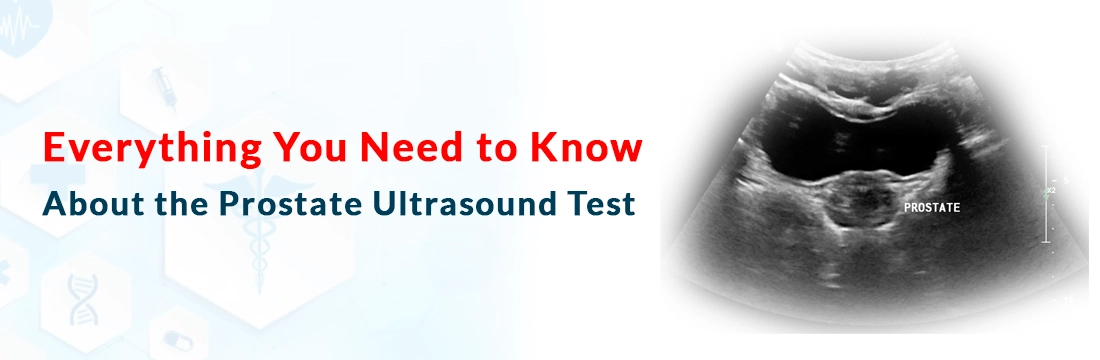 Everything You Need to Know About the Prostate Ultrasound Test